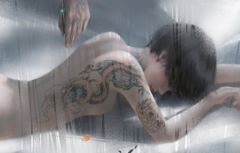 多囊性卵巢综合症（PCOS）的治疗